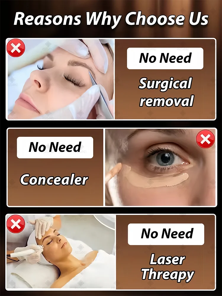 The best products of 2025,ᴵⁿˢᵗᵃⁿᵗˡʸ ʳᵉᵐᵒᵛᵉ ᵉʸᵉ ᵇᵃᵍˢ⸴ ʳᵉᵈᵘᶜᵉ ᶠⁱⁿᵉ ˡⁱⁿᵉˢ⸴ ᵗⁱᵍʰᵗᵉⁿ ˢᵏⁱⁿ⸴ ᶠⁱᵍʰᵗ ᵈᵃʳᵏ ᶜⁱʳᶜˡᵉˢ⸴ ᵃⁿᵈ ᵇʳⁱᵍʰᵗᵉⁿ ᵉʸᵉˢ