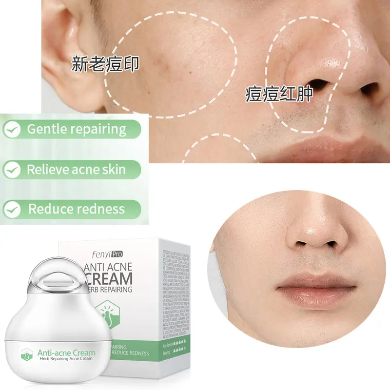 Effective Anti-Acne…