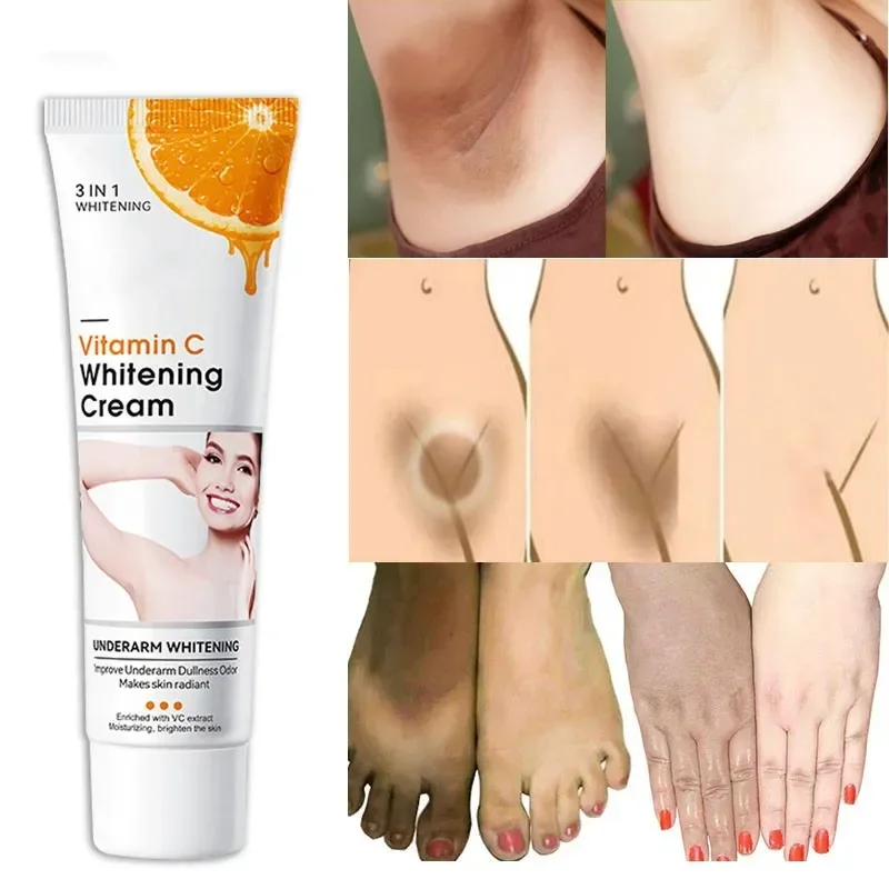 Crema iluminadora con vitamina C, loción corporal hidratante para blanquear axilas, rodillas, codos, ilumina la piel, aclara la melanina