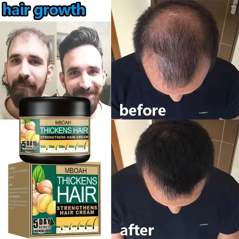 

Крем для роста волос, 7 дней, необходимые капсулы для быстрого восстановления волос, против выпадения волос, восстановление облысения, лечение поврежденной кожи головы для женщин и мужчин