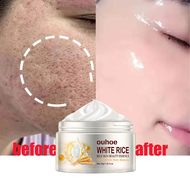 

Moisturizer Rice Anti-wrinkle Facial Cream Acne Melasma Treatment Pigmentation Whitening Face Lifting Beauty Korean Cosmetics