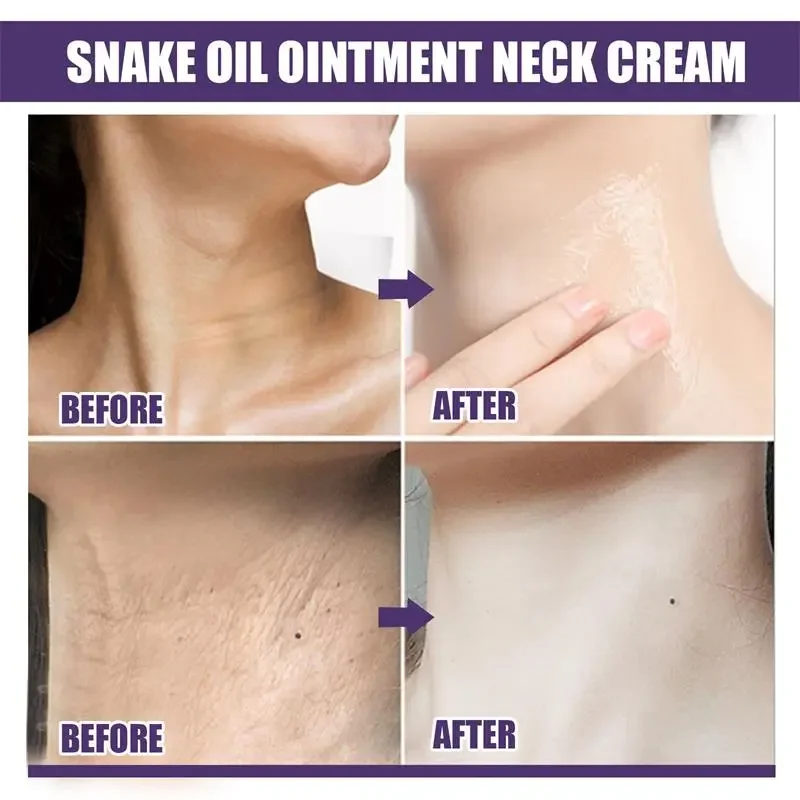 Neck Anti-Wrinkle Cream Rejuvenation Tightening Skin Whitening Moisturizing Anti-Aging Cream Shape Beauty Neck Skin Care Product