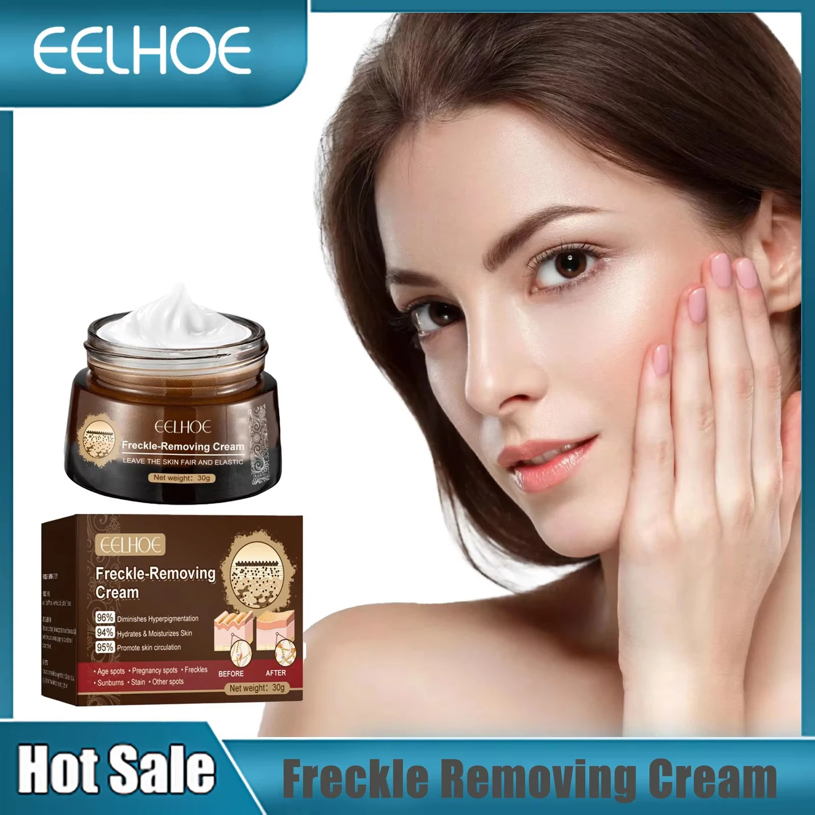 

Freckle Removing Cream Whitening Remove Dark Age Spots Lightening Melasma Pigmentation Corrector Brighten Blemish Removal Cream