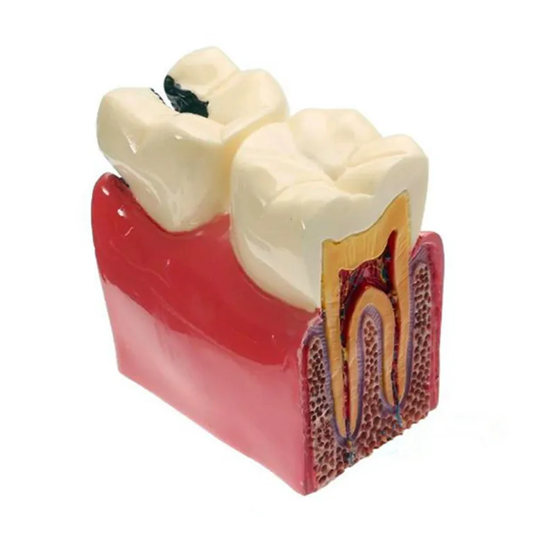 Various dental models for teaching and hospital dental materials