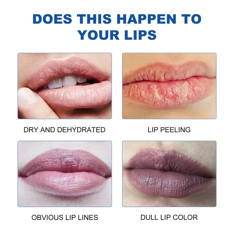 Remover fumaça escura bálsamo labial clareamento melanina brilho óleo lábios batom rosa esfoliante desvanece-se linhas labiais cosméticos coreanos