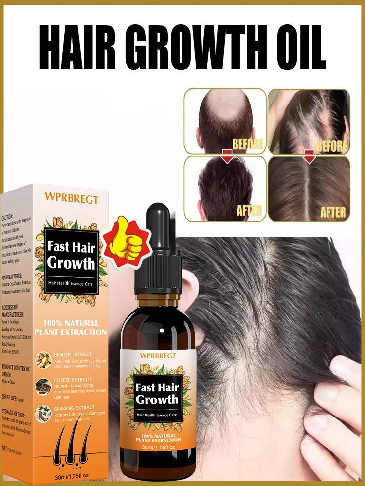 Bᴀʟᴅɴᴇss ᴡᴏʀʀɪᴇs? Hᴀɪʀ ɢʀᴏᴡᴛʜ sᴘʀᴀʏ ᴘʀᴏᴍᴏᴛᴇs ʜᴀɪʀ ɢʀᴏᴡᴛʜ ɪɴ 7 ᴅᴀʏs