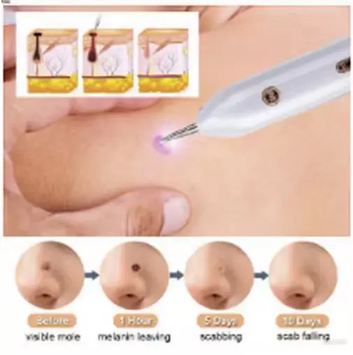 Household cleaning, skin care and beauty equipment for removing moles accessories