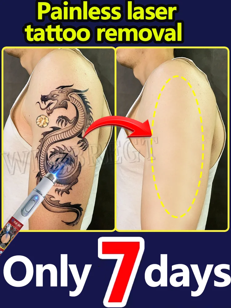 

2-е поколение быстро проникает глубоко в кожу и безболезненно удаляет татуировки любого размера.