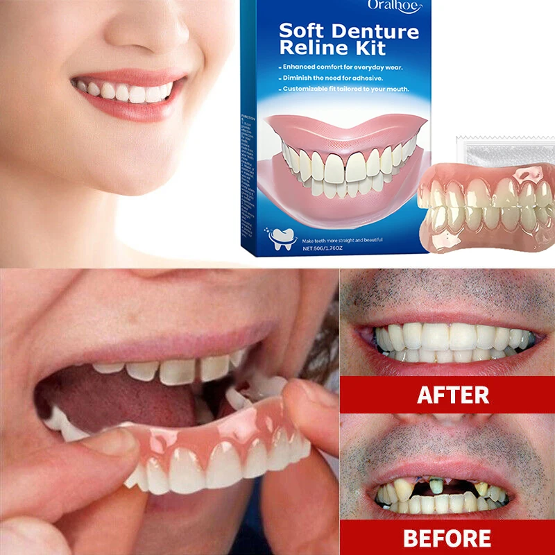 Kit de prothèse dentaire en Silicone, doublures en Silicone, Kit de prothèse dentaire souple, ensemble de dents supérieures et inférieures, facile à utiliser