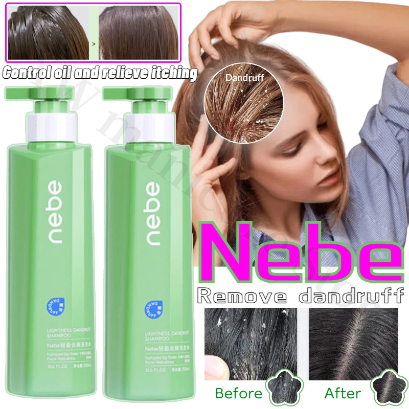 Nebe Anti-Dandruff Shampoo Deeply Cleans The Scalp Controls Oil Relieves Itchiness Is Plump Fluffy Smooth and Leaves Fragrance