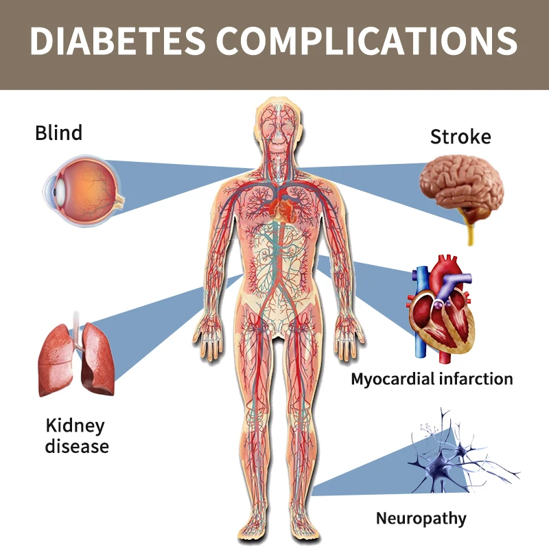 Parche para diabéticos, 6 piezas = 1 bolsa, estabiliza el nivel de azúcar en sangre, equilibrio de glucosa en sangre, tratamiento de la Diabetes,