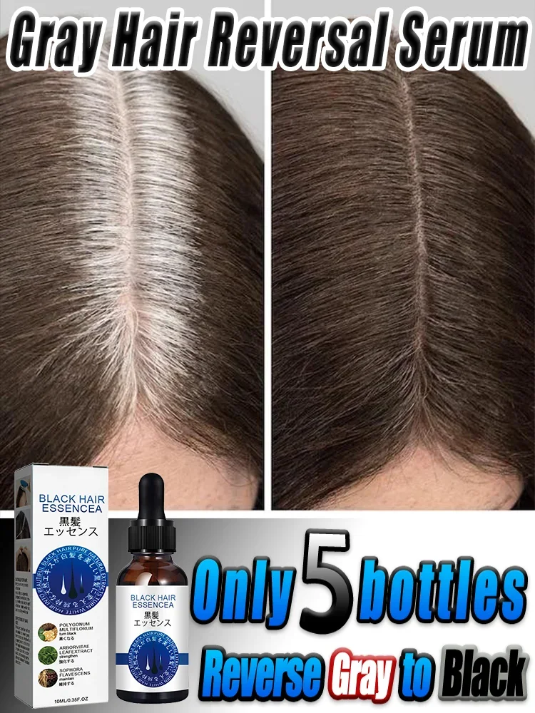 

Effective Gray Hair Serum Anti gray hair Reverse Gray To Original Color White Hair Treatment Nourish Scalp