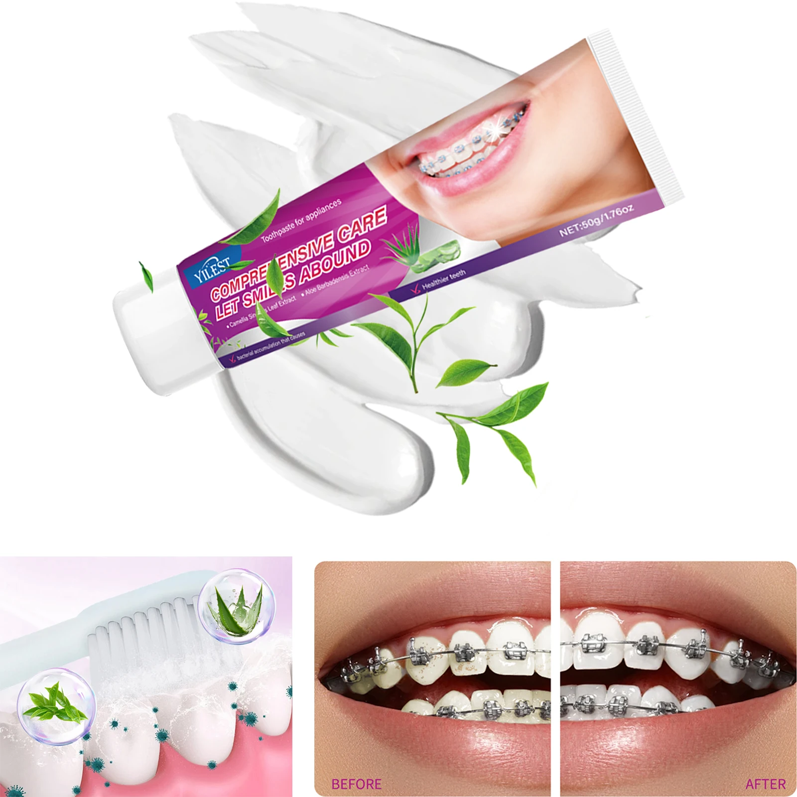 

YILEST 50g Braces Toothpaste 3 Stain Removal (Coffee/Tea/Smoke) Suitable for Oral Fresh Breath & Deep Cleaning
