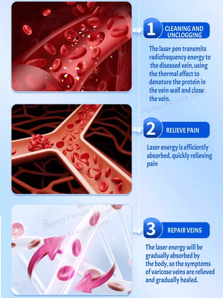 Varicose Veins Products