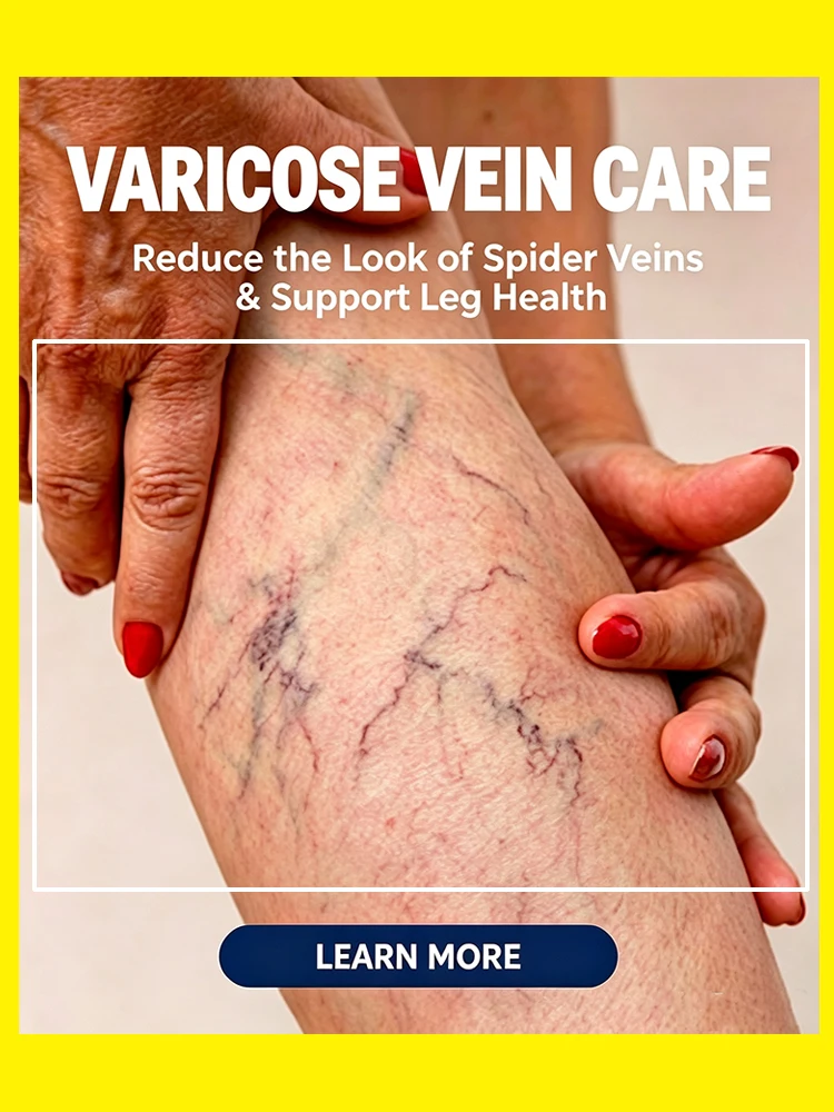Herbal Varicose Veins Cream Leg Care Vein