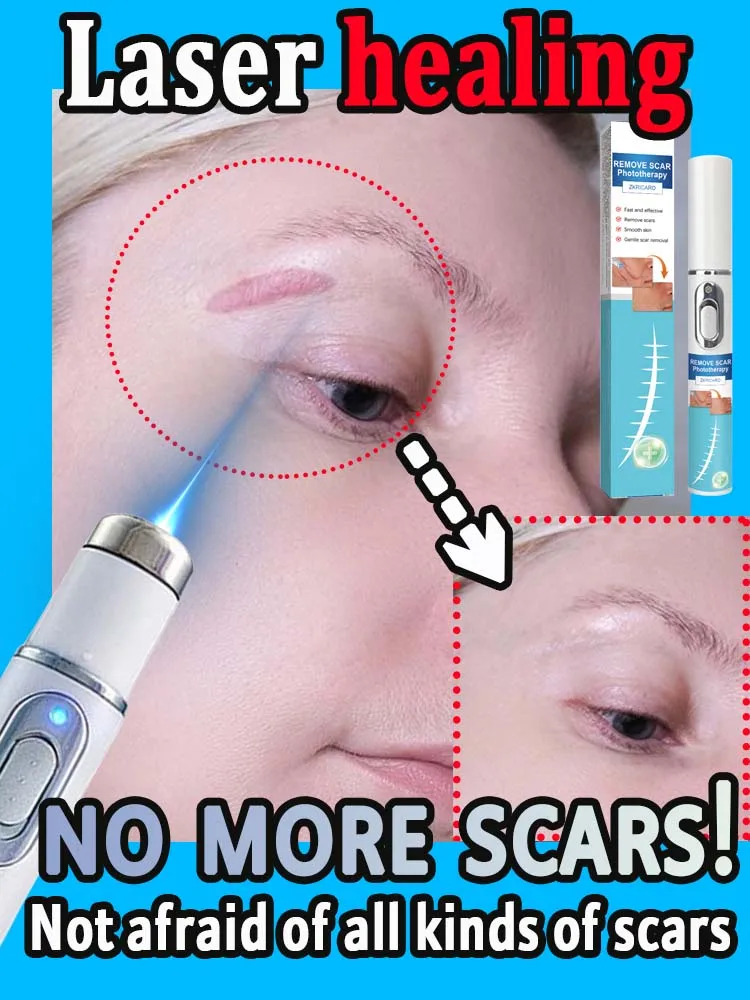 Laser Scar Hot Selling