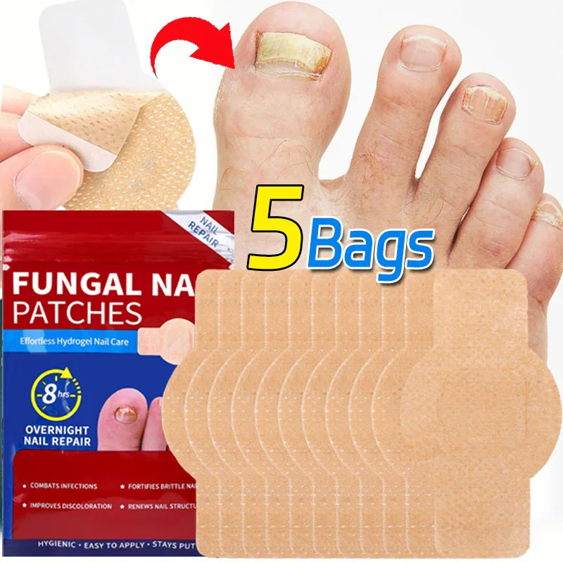 Remendo de fungo de unha à prova d'água, 21/105 peças, adesivo de correção de unhas encravadas, adesivo de cuidados cinza para unhas danificadas, ferramentas de cuidados com os pés