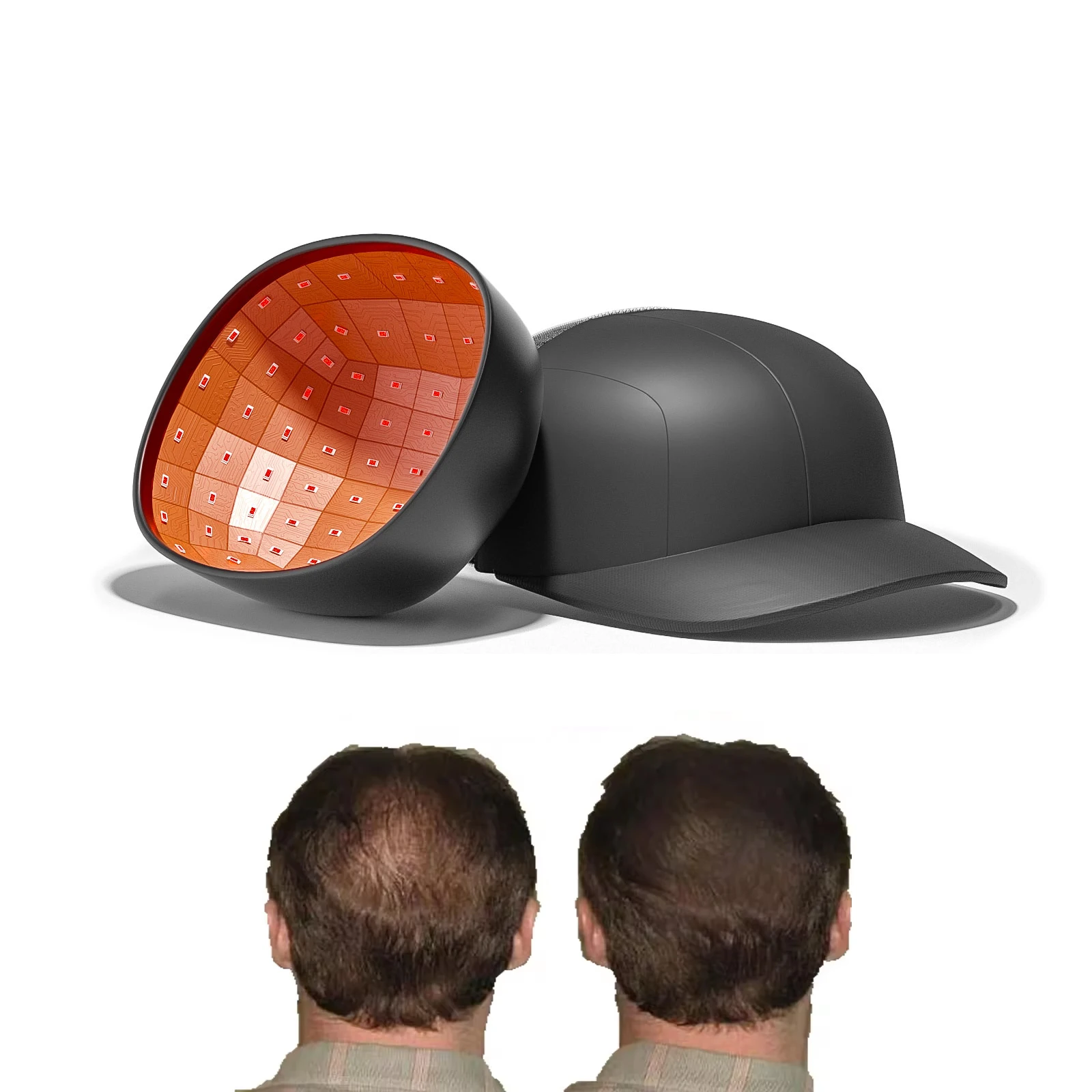 LASEPREHT 96 diodes 650nm laser hair growth therapy cap hair loss prevention for hair regrowth for alopecia areate and bald