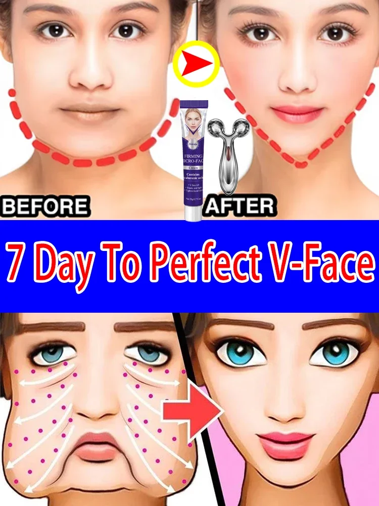 

Fat removal for double chin and V-shaped face