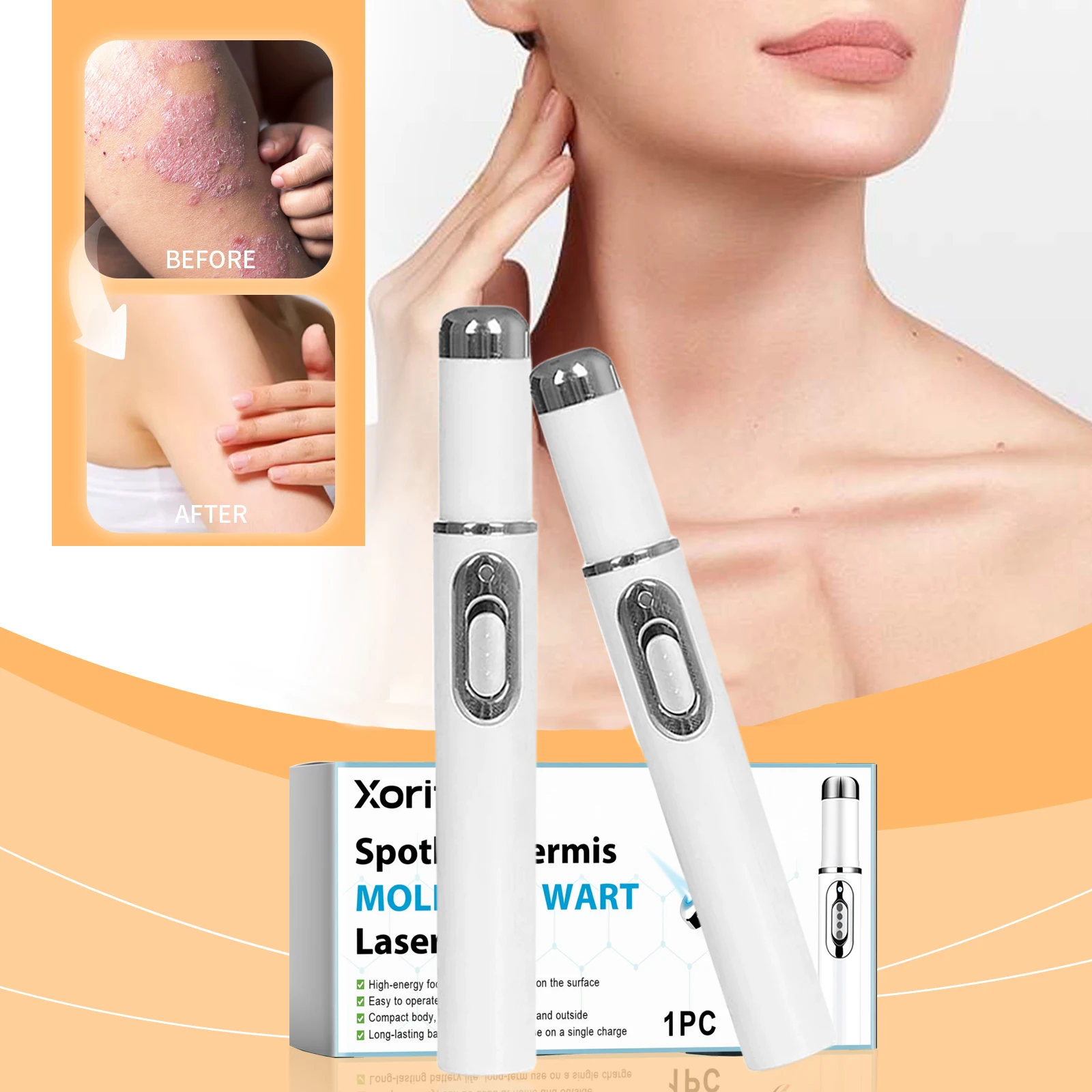 

Laser Skin Treatment Relieves Skin Itching Relieves Itching Redness Reduces Erythema Skin Care Eczematoid Anti-itching Foot Care