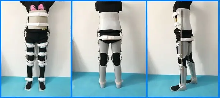 Falling ring lock fixation of knee joint, leg, ankle brace, orthosis bracket, rehabilitation assisted standing and walking