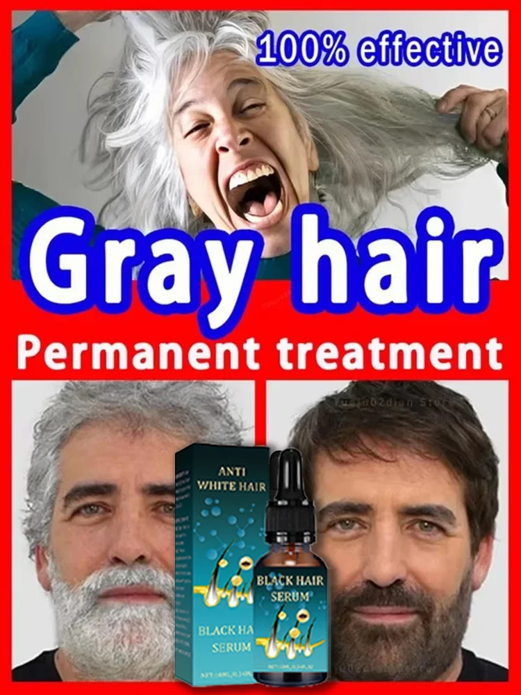 White Hair Care Grey hair Serum White hairs essence Anti-gray hair, Regrow black hairSerum White hairs essence regrow black hair