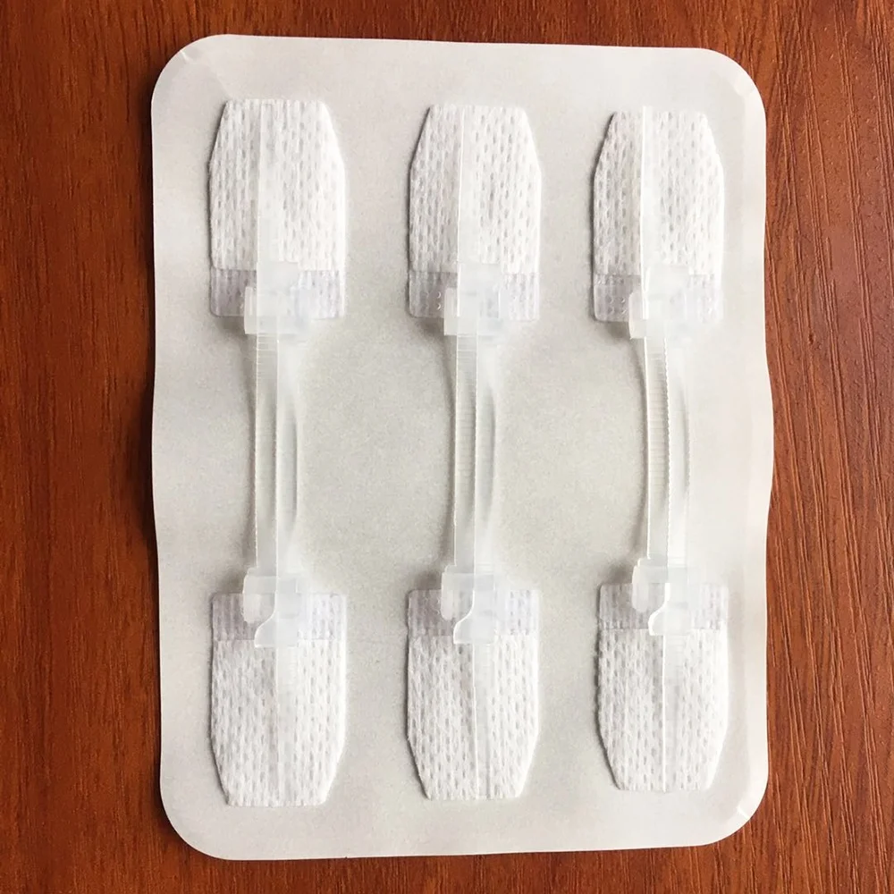 Zip Wound Closure System Without Stitches