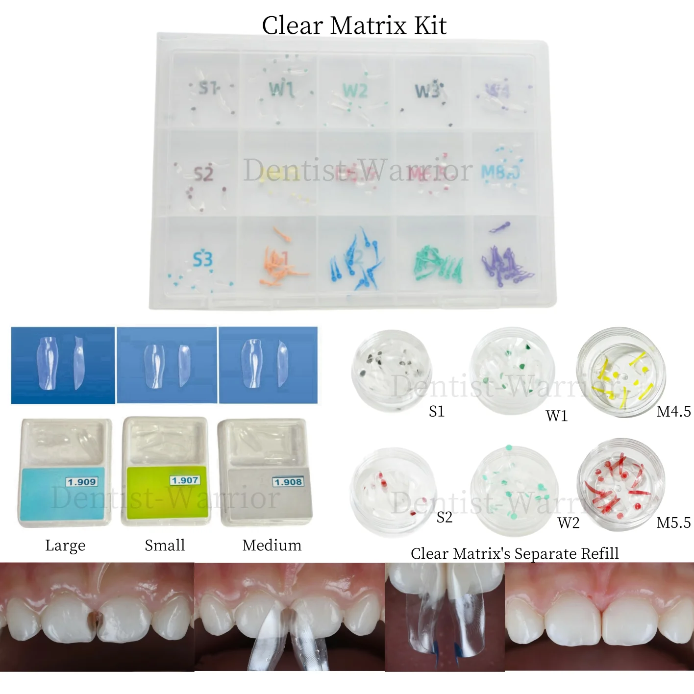 

Dental Clear Matrix Transparent BT Closure Matrices Diastema Wedges Similar with BioClear Diastema Class Restoration