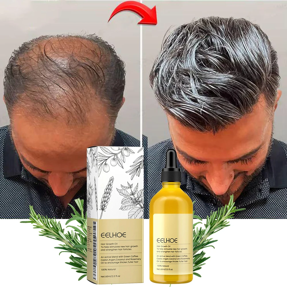 Rosemary Essential Oil for Thick Hair, 1Pcs Vegan Lavender, Repair Hair Damage, Prevent Hair Loss, Soften Hair