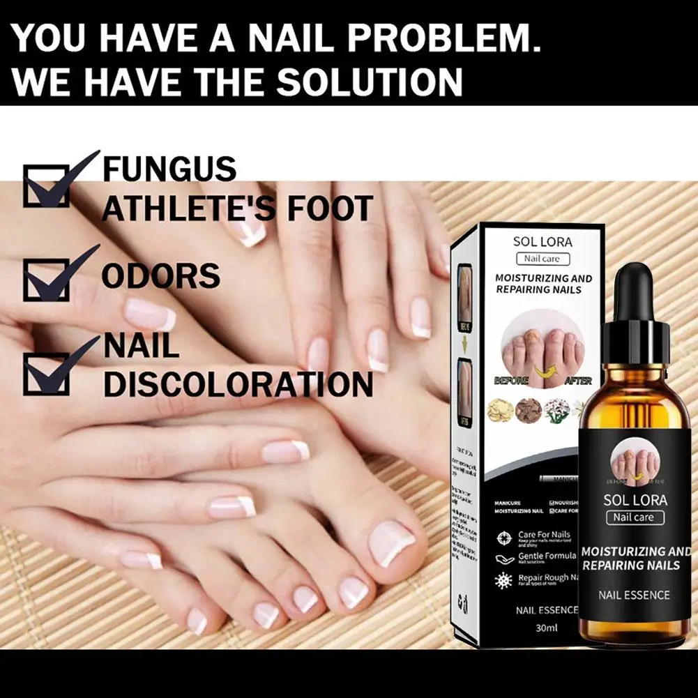 30ml Nail Fungus Treatment Serum Essence Oil Care Repair Feet Anti Nails Removal Toe Essence Cream Infection Gel P4y9