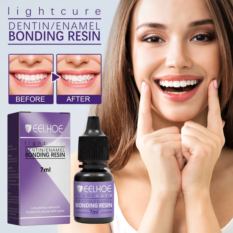 Tand Gem Lijm Tandheelkundige Lijm voor Tand Edelstenen Kit Lijm Tanden Kristallen Sieraden Stevige Tand Sieraden Orthodontische Gel