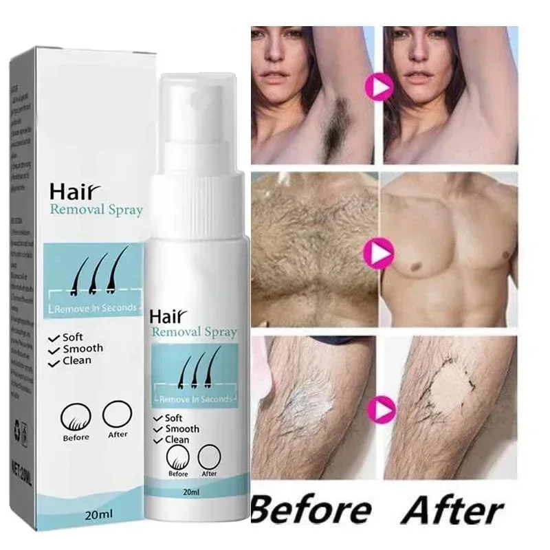 Pulverizador permanente da remoção do cabelo para senhoras, removedor indolor do cabelo, axila, pés, braços, inibidor do crescimento do cabelo, cuidado depilatório do creme de corpo