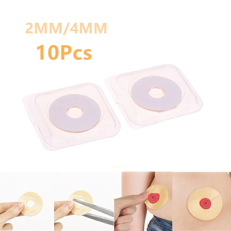 Anillo antifugas para bolsa de colostomía, anillo de pasta de ostomía, placas base, productos para el cuidado del estoma para proteger la piel, 10 Uds.