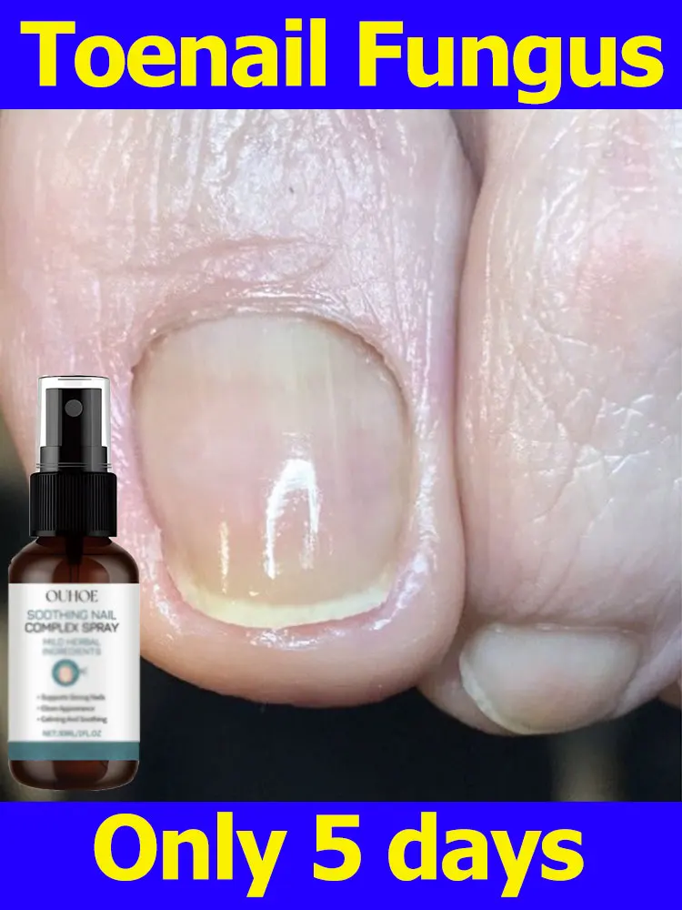 

Nail Protection Socks Toenail