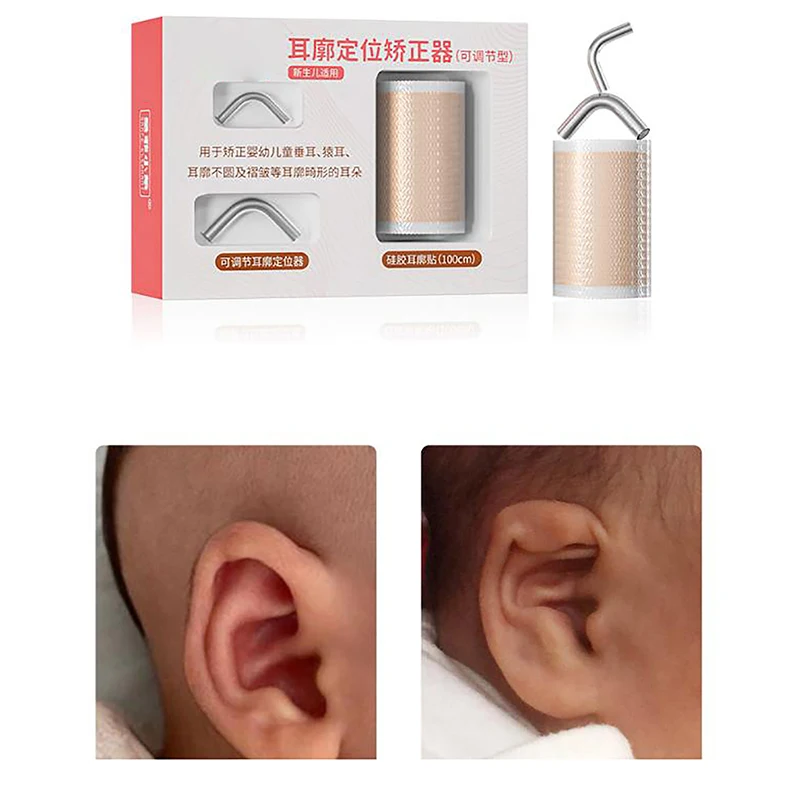 1Roll Tape Baby EarCorrector Cuttable Breathable Infant Toddler Auricle Valgus Silicone Correction Patch With Ear Support Patche