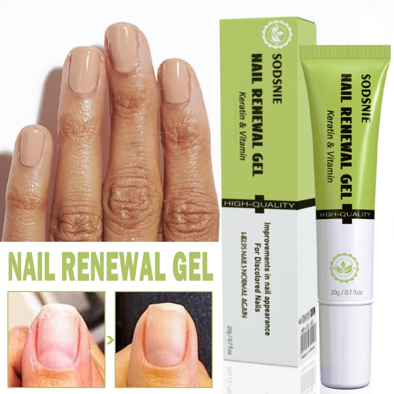 Keratin Nail Renewal Gel Finger Foot Care Nourishing Nail Cuticle Strengthen Nails Restore Normal Nails 20g