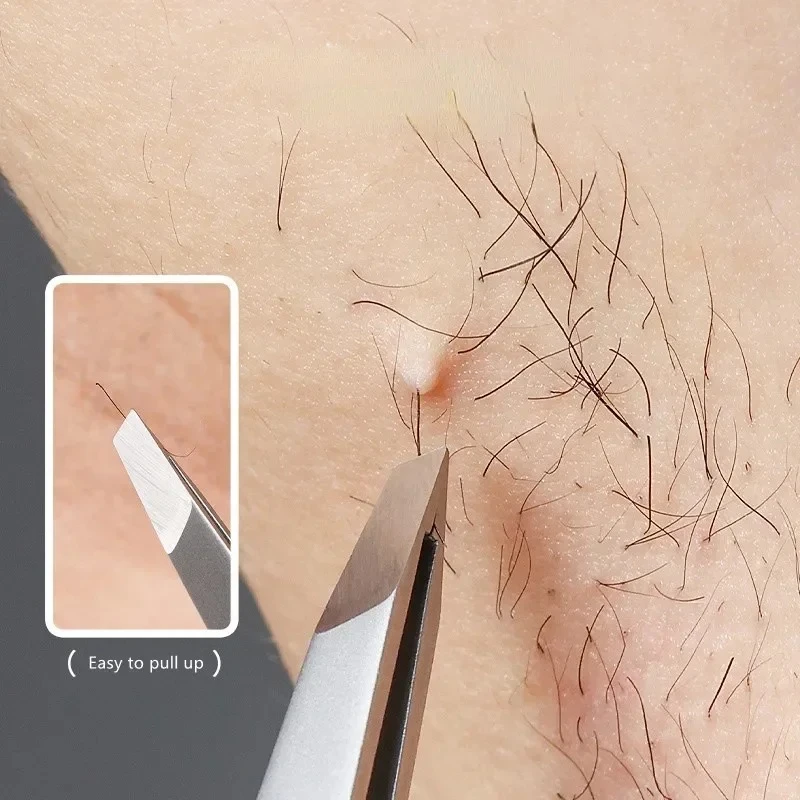 ใหม่แหนบคิ้วที่หนีบคิ้วที่มีมุมเครื่องมือเครื่องสำอางกำจัดขนตัวต่อขนตาอุปกรณ์เสริมเปลือกตาคู่