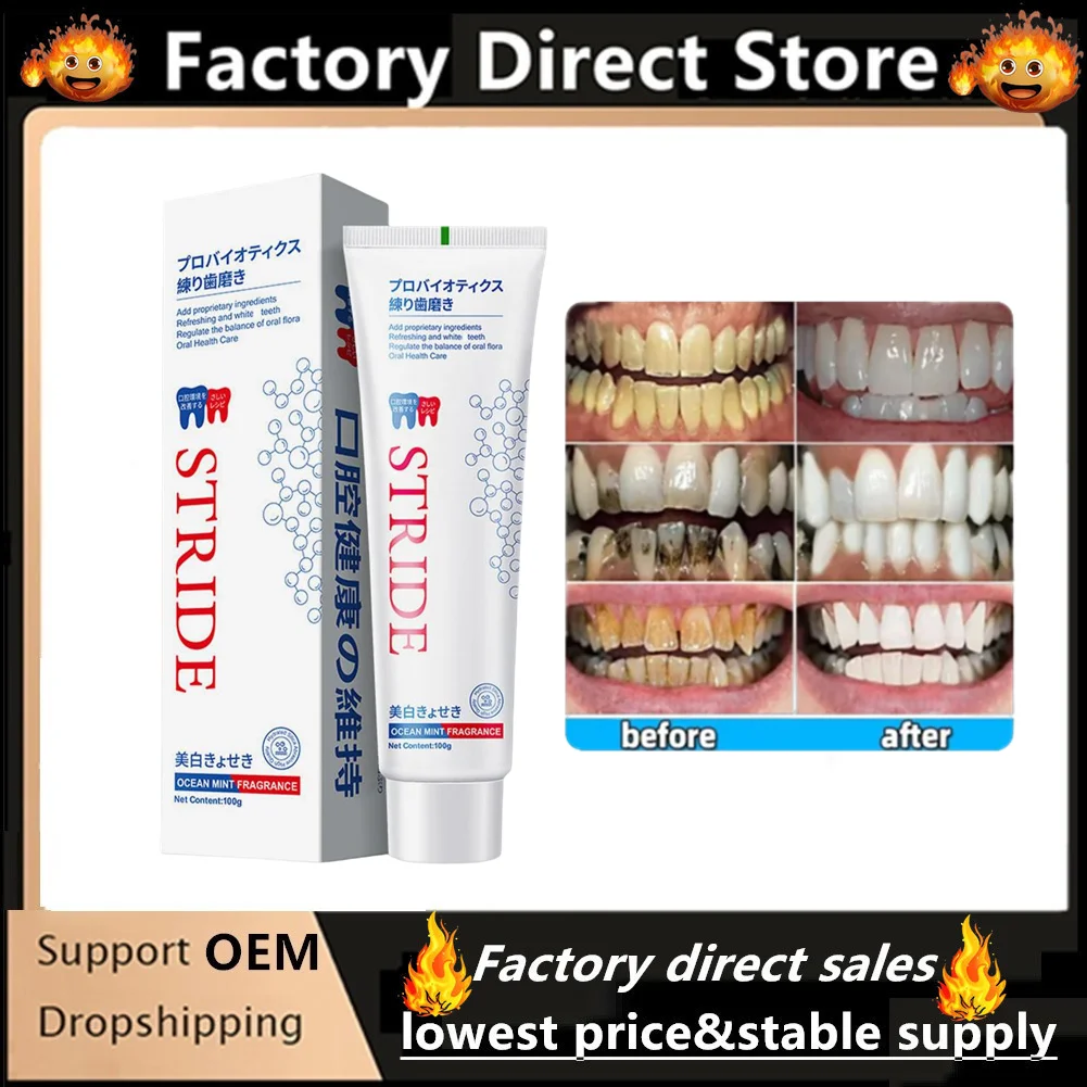 Eliminador de cálculo Dental, pasta de dientes para el mal aliento, brillo, previene la periodontitis, cuidado de limpieza Dental, 100g