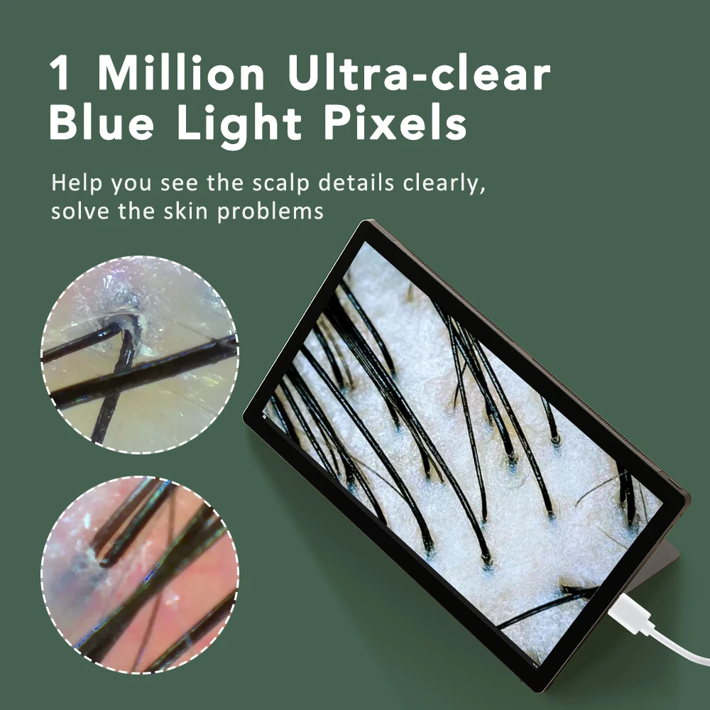 Multifunctionele Hoofdhuid Huid Haarfollikel Detector HD Visuele Huidanalysator Machine Vergrootglas Dermatoscoop Telefoon Tablet Verbinding