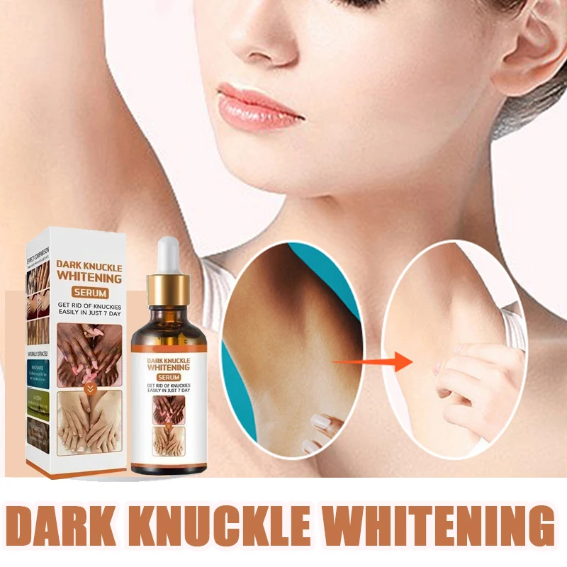 

Dark Knuckles Whitening Skin Armpit Lightening Intimate Areas Underarm Body Skin Care Private Parts Whiten Cream Beauty Health