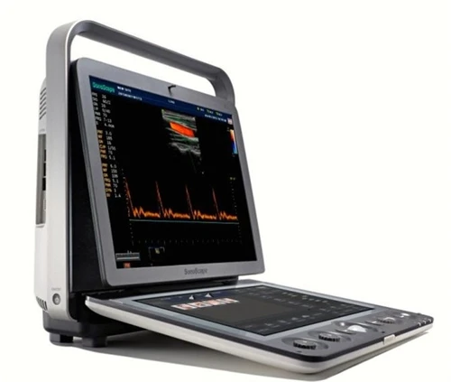 Products subject to negotiationSonoscape supplier S9 pro medical ultrasound instruments medical ultrasound system