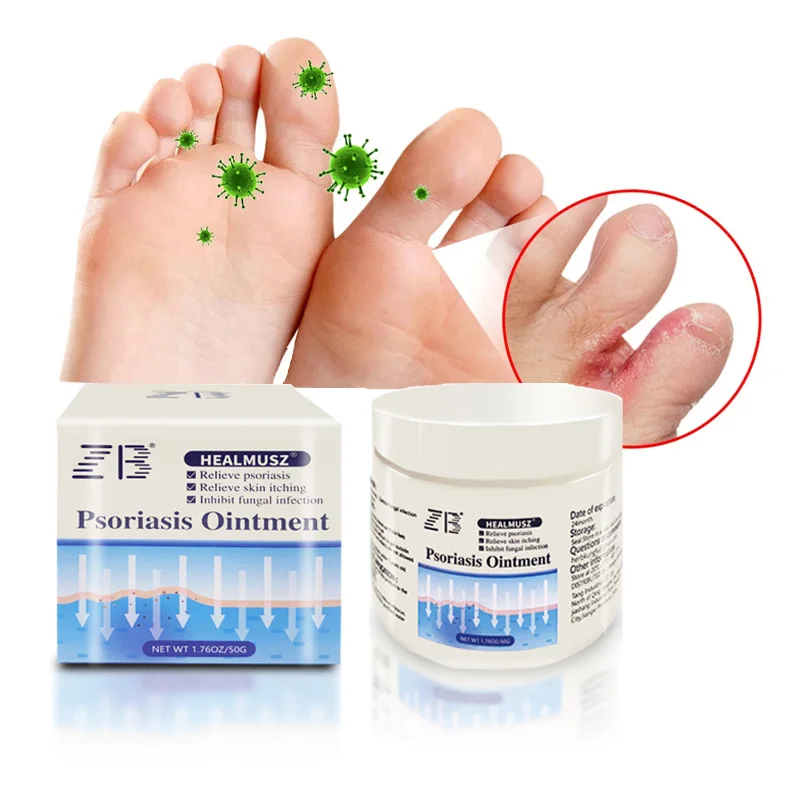 50g Chinese Beriberi Ointment Inhibit Fungi Remove Odor Repair Foot Skin Athlete\'s Foot Treatment Cream Tinea Pedis Cream