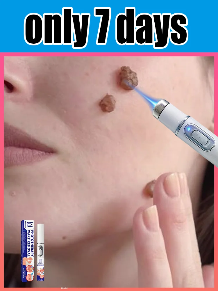 

ʙʟᴜᴇ ʟɪɢʜᴛ ᴘᴇɴ sᴏʟᴠᴇ ᴡᴀʀᴛs, ʜᴏᴛ sᴀʟᴇ ᴡᴀʀᴛ ᴄᴀʀᴇ ᴛᴏᴏʟs