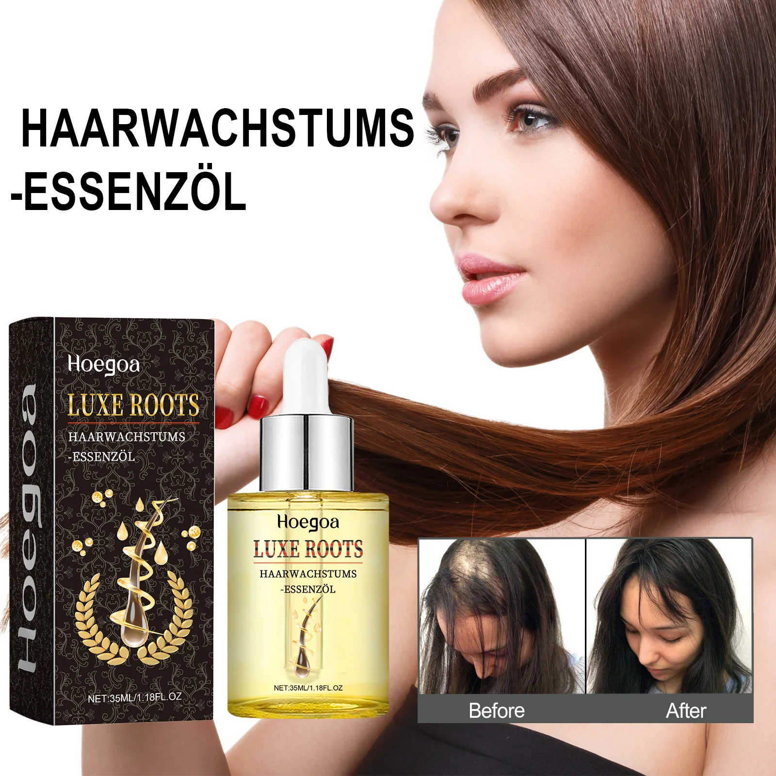 Luxe Roots Haarwachstums -Essenzol Hair Growth Scalp Massage Treatment Moisturizing Supple Plump Dense Hair Care Essential Oil