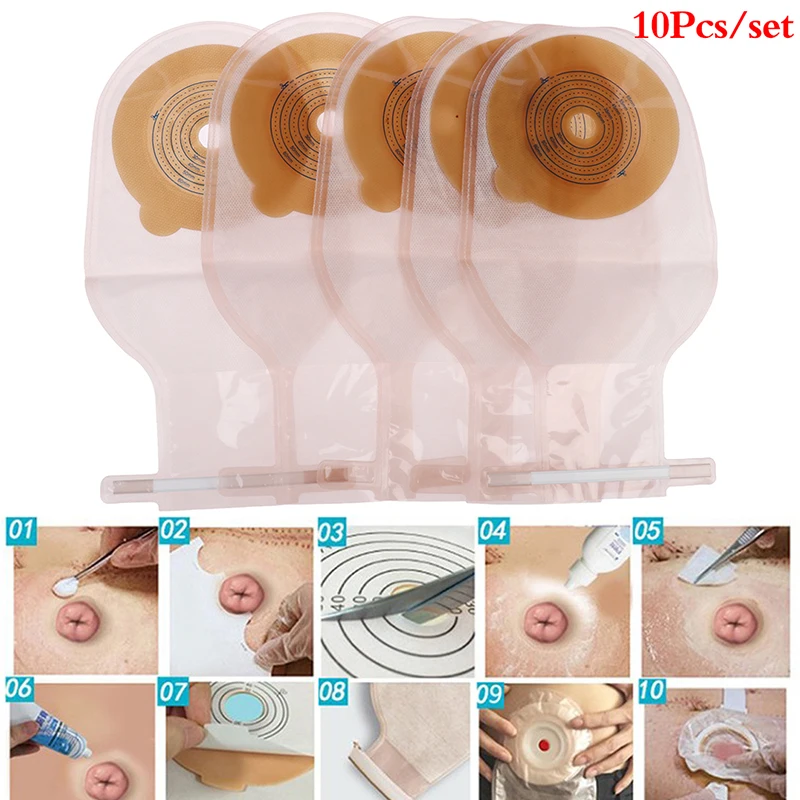 

10pcs Colostomy Bags Max Stoma 25-60mm Skin Color Ostomy Bags with Hook & Loop Back Window Drainable Ostomy Pouch