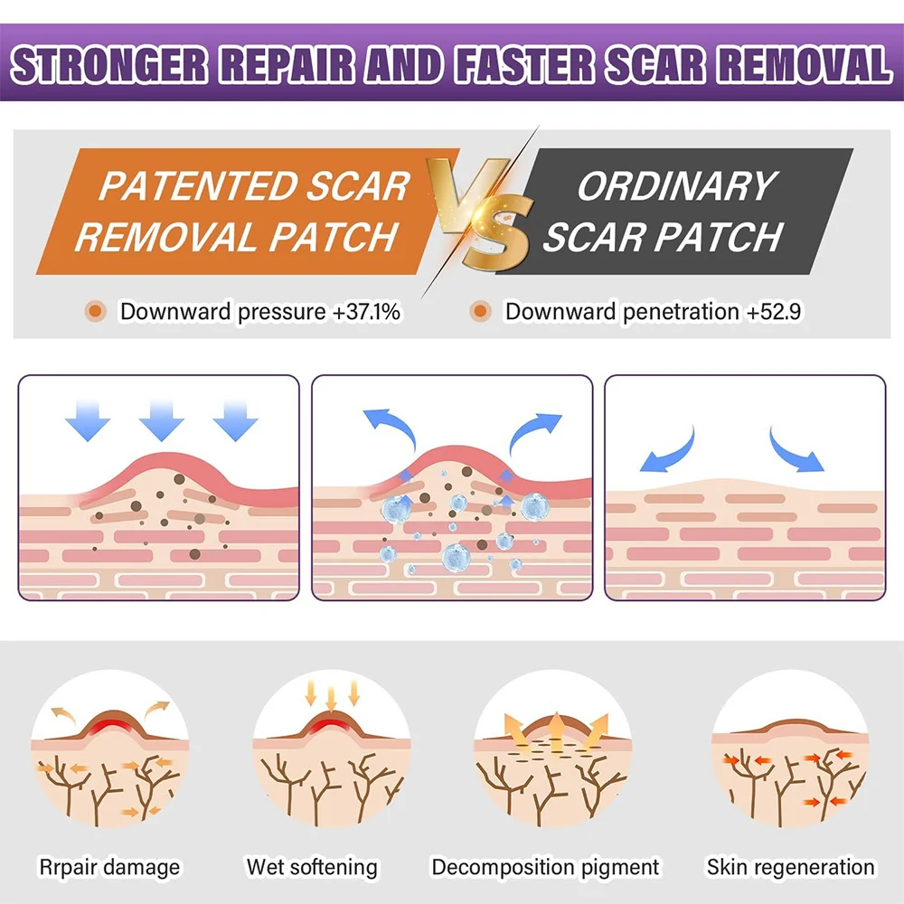

Silicone Scar Tape Silicone Scar Sheets Silicone Scar Removal Strips for Surgical,c-Section,tummy Tuck,keloid Scars Bump Removal