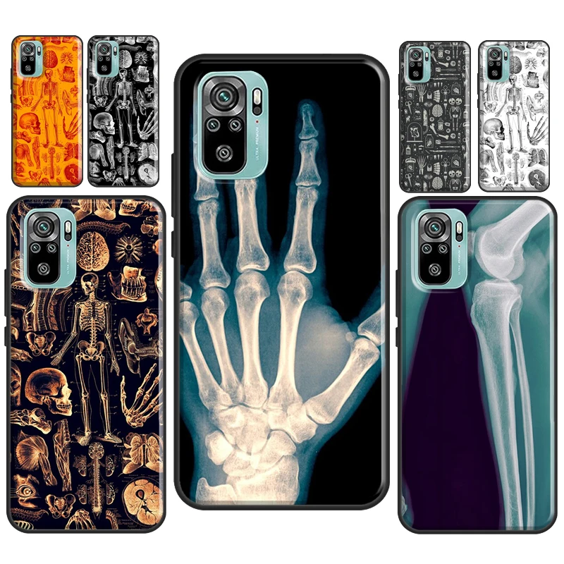 X-Ray Human Anatomy Case For Xiaomi Redmi Note 11 Pro Note 10 8 9 Pro 9S 10S 11S Cover For Redmi 9 10 9C 9A 9T