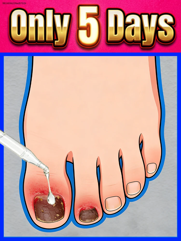 Sᴀʏ ɢᴏᴏᴅʙʏᴇ ᴛᴏ ᴅᴀᴍᴀɢᴇᴅ ɴᴀɪʟs, ʀᴇɴᴇᴡ ᴛᴇxᴛᴜʀᴇ ғᴏʀ sᴍᴏᴏᴛʜ ᴘᴇʀғᴇᴄᴛɪᴏɴ.