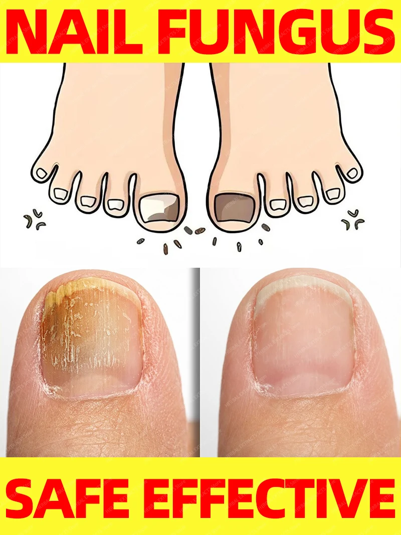 

Solves all nail problems repair feet nails