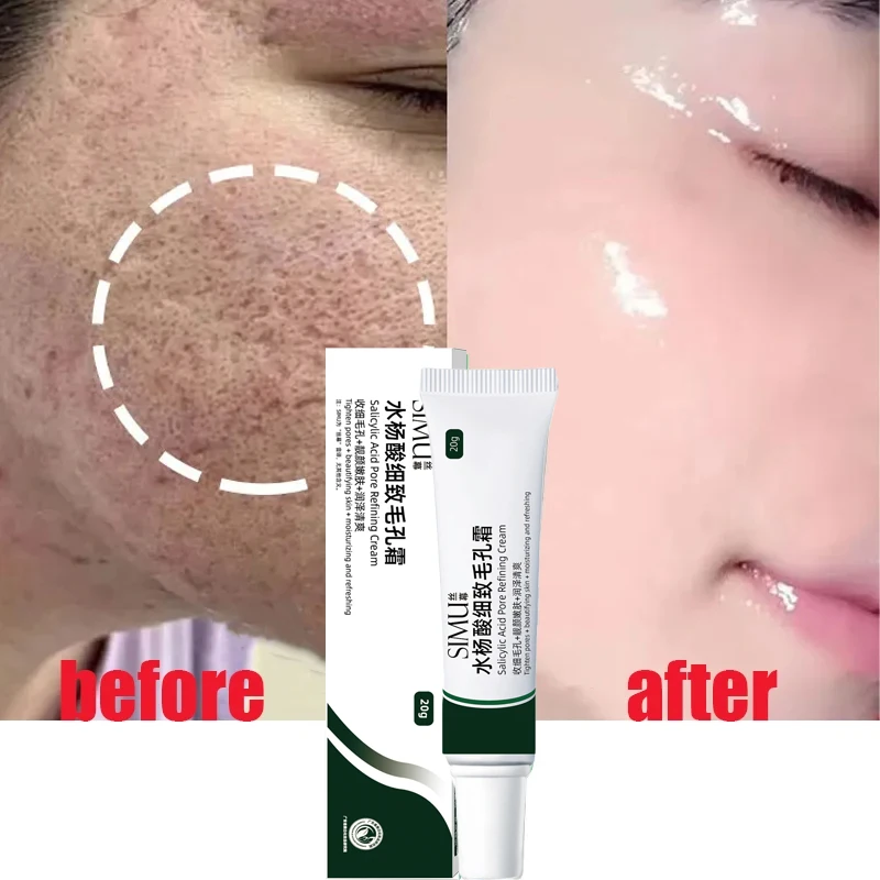 

Salicylic Acid Pore Shrinking Cream Quick Elimination Large Pores Remove Blackehead Tighten Face Smooth Skin Korean Care Product